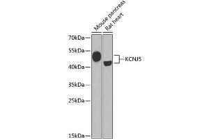Western blot analysis of extracts of various cell lines, using KCNJ5 Antibody (ABIN6134098, ABIN6142740, ABIN6142741 and ABIN6221828) at 1:1000 dilution.