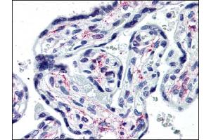 Immunohistochemistry (IHC) image for anti-Interleukin 1 Receptor, Type I (IL1R1) (Extracellular Domain) antibody (ABIN614470)