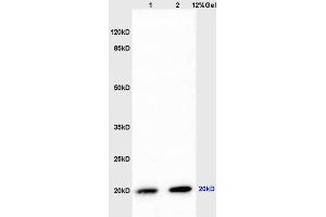 Rat brain lysates probed with Anti CAP1/PARK7 Polyclonal Antibody, Unconjugated (ABIN674739) at 1:200 overnight at 4 °C. (PARK7/DJ1 anticorps  (AA 101-189))
