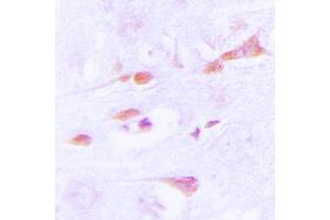 Immunohistochemical analysis of CaMK2 alpha/delta staining in human brain formalin fixed paraffin embedded tissue section. (CaMK2 alpha/delta anticorps  (Center))