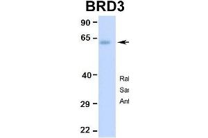 Hum. (BRD3 anticorps  (Middle Region))