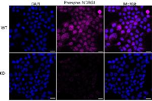 Immunocytochemical staining of HeLa cells using Phospho-NDRG1 (Ser330) antibody (ABIN7799537), 1:1,000), Top panel: wild-type (WT), Bottom panal: Phospho-NDRG1 (Ser330) shRNA knockdown (KD).