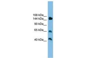 Image no. 1 for anti-Jumonji, AT Rich Interactive Domain 2 (JARID2) (AA 201-250) antibody (ABIN6744599) (JARID2 anticorps  (AA 201-250))
