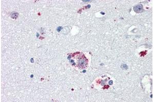 Anti-TAAR8 / TA5 antibody IHC staining of human brain, amygdala. (Trace Amine Associated Receptor 8 (TAAR8) (N-Term) anticorps)