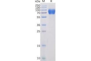 Human SLAMF1 Protein, mFc-His Tag on SDS-PAGE under reducing condition. (SLAMF1 Protein (mFc-His Tag))