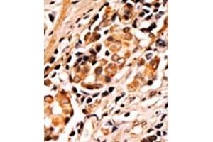 Image no. 2 for anti-BCL2-Associated Agonist of Cell Death (BAD) (pSer75) antibody (ABIN358086) (BAD anticorps  (pSer75))