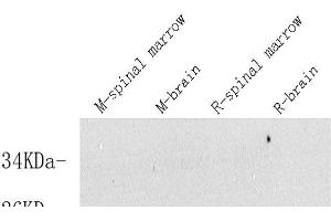 Western Blot analysis of various samples using VIP Polyclonal Antibody at dilution of 1:600. (Vip anticorps)