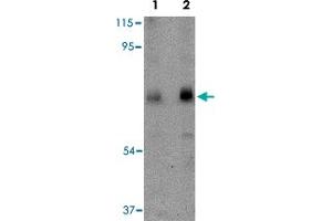 Western blot analysis of CAPN6 in rat lung tissue lysate with CAPN6 polyclonal antibody  at (Lane 1) 0. (Calpain 6 anticorps  (C-Term))