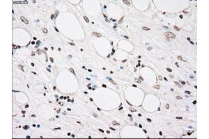 Image no. 3 for anti-Polo-Like Kinase 1 (PLK1) antibody (ABIN1500281)