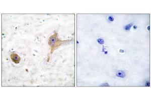 Immunohistochemical analysis of paraffin-embedded human brain tissue using GABA B Receptor antibody.