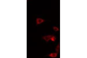 ABIN6275461 staining  HeLa cells by IF/ICC. (RAB20 anticorps  (Internal Region))