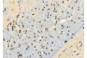 ABIN6265054 and ABIN6279815 at 1/100 staining Mouse brain tissue by IHC-P.