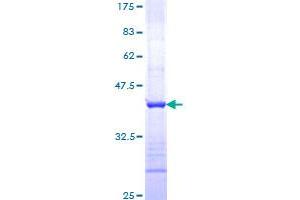 Image no. 1 for Suppression of Tumorigenicity 14 (ST14) (AA 298-400) protein (GST tag) (ABIN1321474)