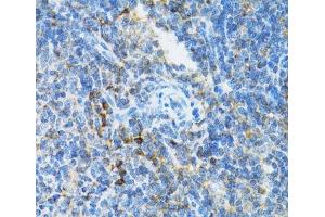 Immunohistochemistry of paraffin-embedded Mouse spleen using UBE2D1 Polyclonal Antibody at dilution of 1:100 (40x lens).