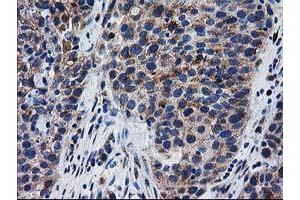 Image no. 6 for anti-Bridging Integrator 3 (BIN3) antibody (ABIN1496923)