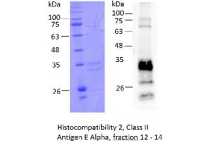 Image no. 2 for Histocompatibility 2, Class II Antigen E Alpha, Pseudogene (H2-EA-PS) (AA 26-255) protein (rho-1D4 tag) (ABIN3132417)