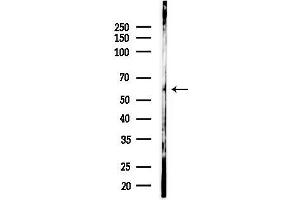 anti-Sterile alpha Motif Domain Containing 3 (SAMD3) antibody