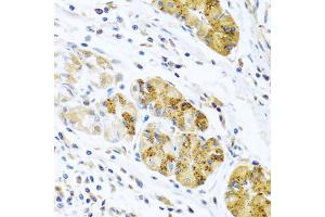Immunohistochemistry of paraffin-embedded human stomach using CCL8 antibody (ABIN5975074) at dilution of 1/100 (40x lens).