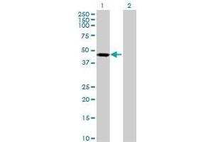 Lane 1: KRT36 transfected lysate ( 47. (KRT36 293T Cell Transient Overexpression Lysate(Denatured))