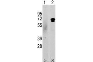 Western blot analysis of CAMKK2 antibody and 293 cell lysate either nontransfected (c) or transiently transfected with the CAMKK2 gene (2). (CAMKK2 anticorps  (AA 52-82))
