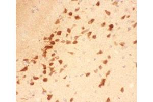 IHC-P testing of rat brain tissue (BDNF anticorps  (AA 129-247))