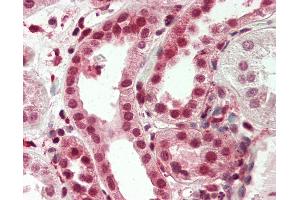 Human Kidney: Formalin-Fixed, Paraffin-Embedded (FFPE)