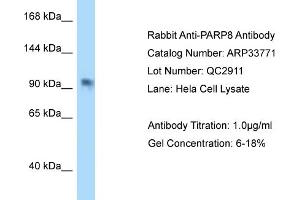 WB Suggested Anti-PAntibody   Titration: 1. (PARP8 anticorps  (C-Term))