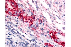 Anti-CRF1 antibody IHC of human pars intermedia.