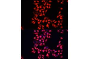 Immunofluorescence analysis of HeLa cells using  antibody (ABIN6129173, ABIN6136519, ABIN6136520 and ABIN6214691) at dilution of 1:100. (ADAM10 anticorps  (AA 214-500))