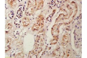Formalin-fixed and paraffin embedded human kidney labeled with Anti-Frizzled 9/CD349 Polyclonal Antibody, Unconjugated (ABIN1386280) at 1:200 followed by conjugation to the secondary antibody and DAB staining