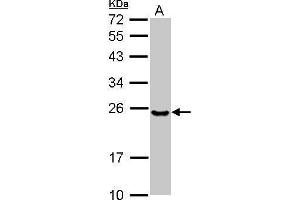 WB Image Sample (30 ug of whole cell lysate) A: NT2D1 12% SDS PAGE antibody diluted at 1:1000