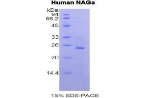 SDS-PAGE analysis of Human NAGa Protein. (NAGA Protéine)