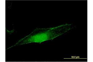 Immunofluorescence of monoclonal antibody to MGEA5 on HeLa cell.