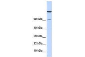Image no. 1 for anti-Zinc Finger Protein 251 (ZNF251) (AA 91-140) antibody (ABIN6740522) (ZNF251 anticorps  (AA 91-140))