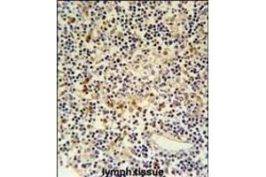 CORO6 Antibody (Center) (ABIN651025 and ABIN2840041) immunohistochemistry analysis in formalin fixed and paraffin embedded human lymph tissue followed by peroxidase conjugation of the secondary antibody and DAB staining. (Coronin 6 anticorps  (AA 196-224))