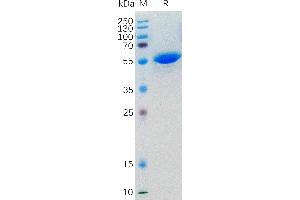 Human LIGHT Protein, hFc Tag on SDS-PAGE under reducing condition.