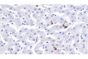 Detection of S100A12 in Bovine Liver Tissue using Polyclonal Antibody to S100 Calcium Binding Protein A12 (S100A12) (S100A12 anticorps  (AA 2-92))