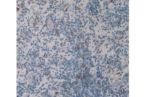 IHC-P analysis of Mouse Spleen Tissue, with DAB staining. (HLA-DRB1 anticorps  (AA 27-264))