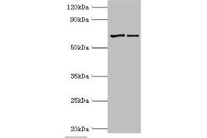 Western blot All lanes: Myotubularin antibody at 2 μg/mL Lane 1: Jurkat whole cell lysate Lane 2: HepG2 whole cell lysate Secondary Goat polyclonal to rabbit IgG at 1/10000 dilution Predicted band size: 70, 67 kDa Observed band size: 70 kDa (MTM1 anticorps  (AA 484-603))