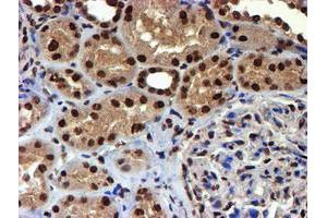 Immunohistochemical staining of paraffin-embedded Human Kidney tissue using anti-TOMM34 mouse monoclonal antibody. (TOMM34 anticorps)