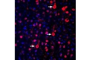 Expression of GPR17 in rat parietal cortex - Immunohistochemical staining of perfusion-fixed frozen rat brain sections with Anti-GPR17 Antibody (ABIN7043149, ABIN7044435 and ABIN7044436), (1:300), followed by donkey-anti-rabbit-biotin and streptavidin-Cy3.