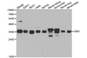 Western blot analysis of extracts of various cell lines, using CBR1 antibody. (CBR1 anticorps  (AA 1-277))