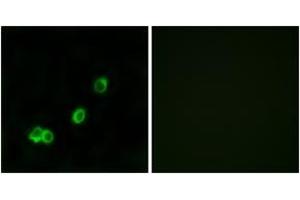 Immunofluorescence analysis of MCF7 cells, using ACOT1 Antibody. (ACOT1 anticorps  (AA 91-140))