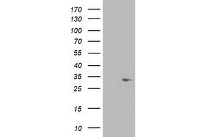 Image no. 1 for anti-Short Chain Dehydrogenase/reductase Family 9C, Member 7 (SDR9C7) (AA 1-313) antibody (ABIN1490738)