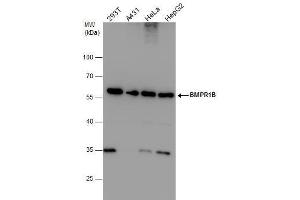 WB Image BMPR1B antibody detects BMPR1B protein by western blot analysis. (BMPR1B anticorps)