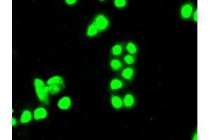 Image no. 8 for anti-Sjogren Syndrome Antigen B (SSB) antibody (ABIN1501143)
