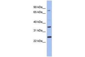Image no. 1 for anti-Zinc Finger Protein 133 (ZNF133) (N-Term) antibody (ABIN6742760) (ZNF133 anticorps  (N-Term))