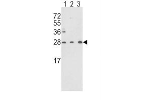 Western Blotting (WB) image for anti-Triosephosphate Isomerase 1 (TPI1) antibody (ABIN3001712) (TPI1 anticorps)