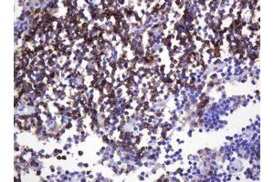 Image no. 1 for anti-Sialophorin (SPN) antibody (ABIN1497318) (CD43 anticorps)