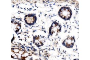 IHC analysis of VPRBP/DCAF1 using anti-VPRBP/DCAF1 antibody (ABIN7602005). (DDB1 and CUL4-Associated Factor 1 (DCAF1) (AA 540-861) anticorps)
